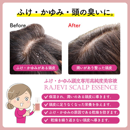 RAJEVI SCALP ESSENCE │ ラジュヴィ スカルプエッセンス